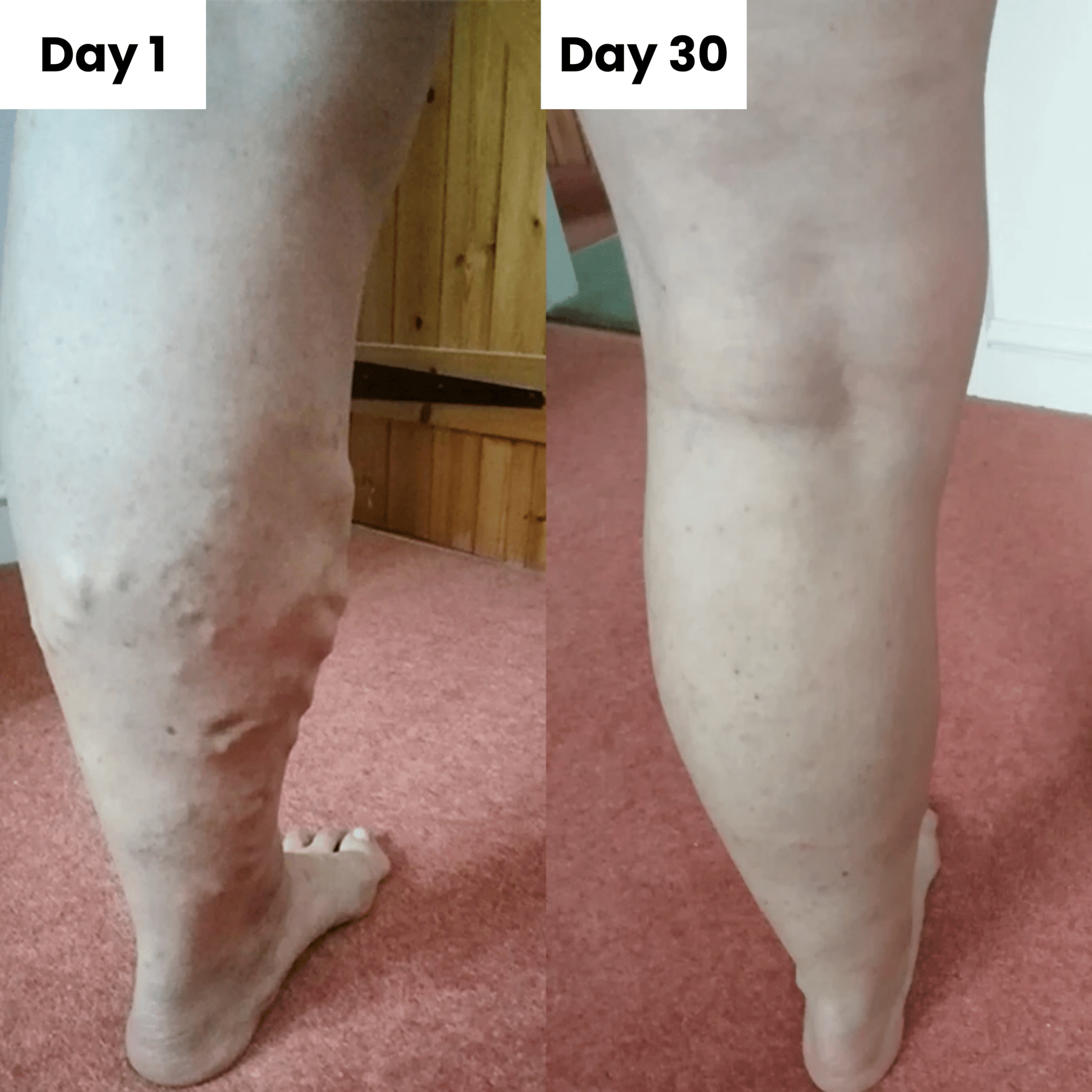 truneste™ All - Natural Plant Powered Veins Cream - Truneste